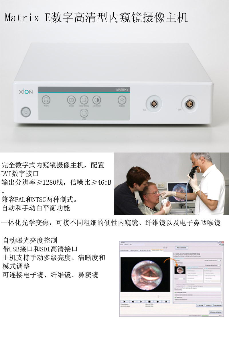 內(nèi)窺鏡2 (2).jpg 內(nèi)窺鏡2 (2).jpg